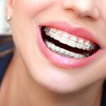 Straighten Your Smile With Clear Braces In Selkirk