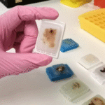 Why Do Medical Sectors Depend on FFPE Human Tissue for Clinical Innovations