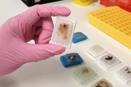 Why Do Medical Sectors Depend on FFPE Human Tissue for Clinical Innovations