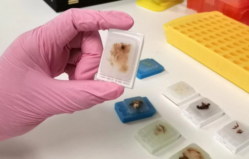 Why Do Medical Sectors Depend on FFPE Human Tissue for Clinical Innovations