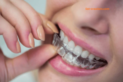 Step-by-Step Journey of Clear Aligner Care Treatment in Kelowna