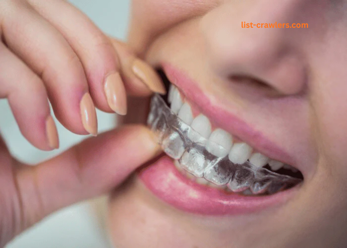 Step-by-Step Journey of Clear Aligner Care Treatment in Kelowna